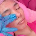 Effective Double Chin Treatment & Skin Tightening Solutions In Dubai