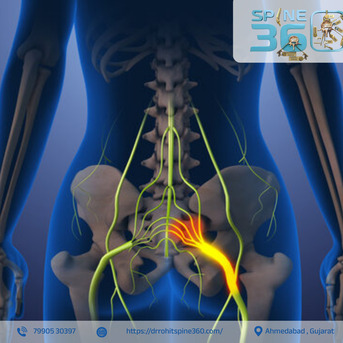 Ahmedabad, Health, Best Sciatica Specialist In Ahmedabad &ndash; Dr. Rohit Thaker