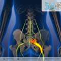 Best Sciatica Specialist In Ahmedabad &ndash; Dr. Rohit Thaker