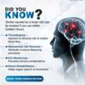 Stroke Care | Best Neurologist | Health Village Hospital.