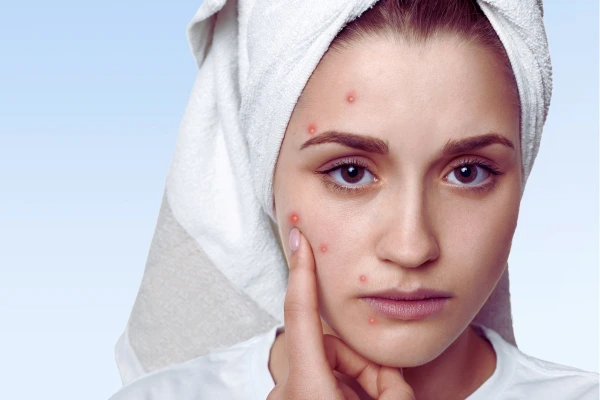 New York, Health, Lightweight Treatment Serum For Clearer Looking Skin