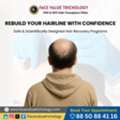 Hairline Transplant In Chennai | Best Hair Restoration Clinic