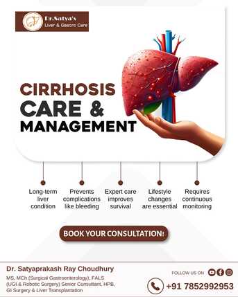 Mumbai, Health, Cirrhosis Care | Best Liver Specialist | Dr Satyaprakash Ray Choudhury.