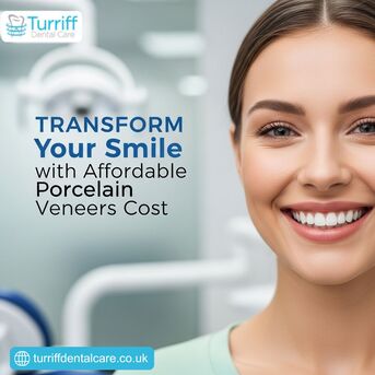 London, Dental, Transform Your Smile With Affordable Porcelain Veneers Cost
