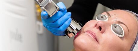 New York, Health, Best Laser Treatment For Aging Skin: Top Solutions For Youthful Glow