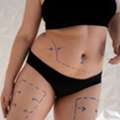 Body Contouring Surgeon Body Contouring Without Surgery