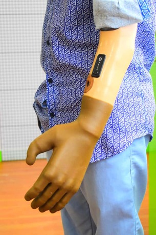 Hyderabad, Health, Free Artificial Leg In Hyderabad | CareVale Prosthetics