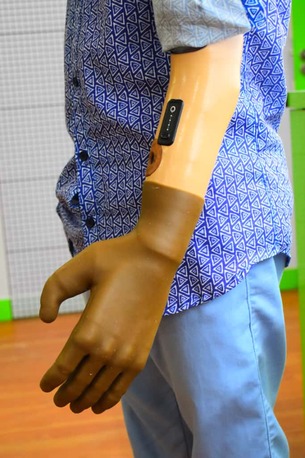 Hyderabad, Health, Free Artificial Leg In Hyderabad | CareVale Prosthetics