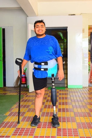 Hyderabad, Health, Free Artificial Leg In Hyderabad | CareVale Prosthetics