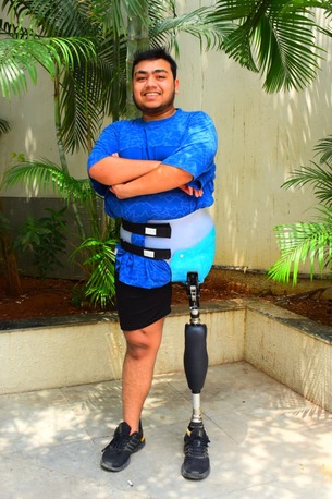 Hyderabad, Health, Free Artificial Leg In Hyderabad | CareVale Prosthetics