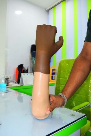 Hyderabad, Health, Free Artificial Leg In Hyderabad | CareVale Prosthetics