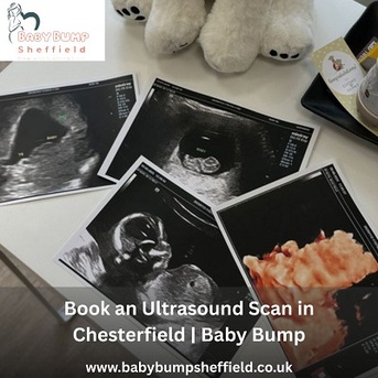 London, Health, Book An Ultrasound Scan In Chesterfield | Baby Bump