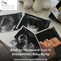 Book An Ultrasound Scan In Chesterfield | Baby Bump