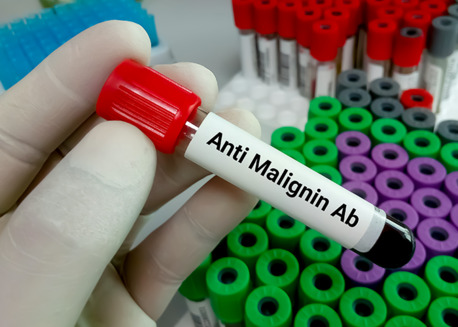 New York, Health, Cas9 Monoclonal Antibody