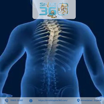Ahmedabad, Health, Leading Scoliosis & Kyphosis Specialist In Ahmedabad - Dr. Rohit Thaker