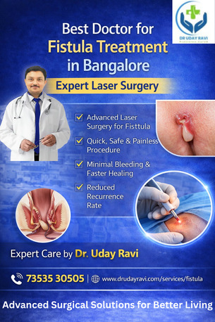Bangalore, Health, Best Doctor For Fistula Treatment In Bangalore | Expert Laser Surgery - Dr. Uday Ravi