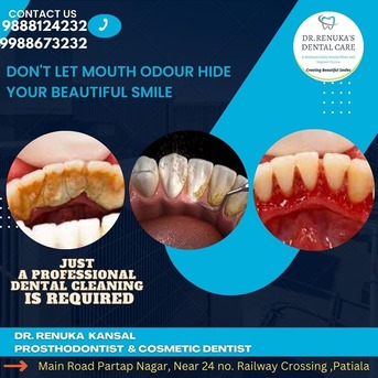 Mumbai, Dental, Looking For Best Dental Clinic In Patiala? Get Expert Care &ndash; Book Today