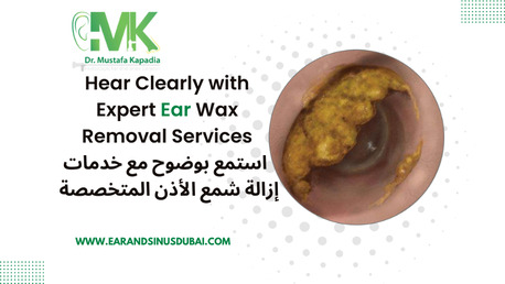 Dubai, Health, Ear Wax Removal In Dubai | Dr. Mustafa Kapadia
