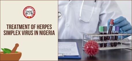 Kolkata, Health, Treatment Of Herpes Simplex Virus In Nigeria