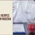 Treatment Of Herpes Simplex Virus In Nigeria