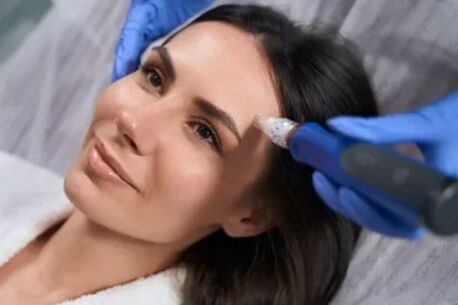 New York, Business, Microneedling Treatment Near Me For Radiant Skin