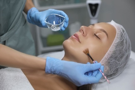 Dubai, Beautician, Chemical Peels For Pigmentation In Dubai: A Complete Skin Rejuvenation Guide