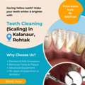 Teeth Cleaning In Kalanaur, Rohtak | Triveni Dental