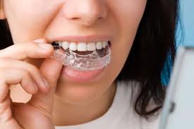 Singapore, Dental, Is Braces Treatment Right For You? 4 Key Considerations