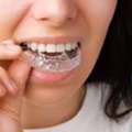 Is Braces Treatment Right For You? 4 Key Considerations