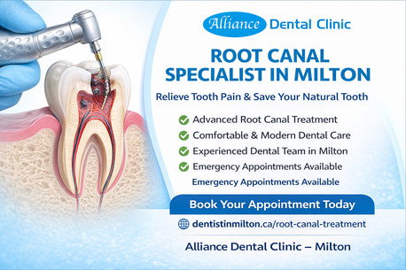 Toronto, Health & Beauty Items, Root Canal Specialist In Milton &ndash; Save Your Tooth With Advanced Dental Care