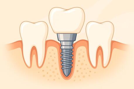 Washington DC, Health, Best Dentures Implants Treatment Center In Portland,OR !