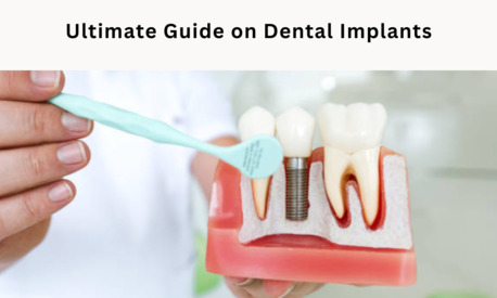 Washington DC, Health, Best Dentures Implants Treatment Center In Portland,OR !