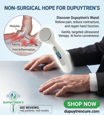 New York, Health & Beauty Items, USD 177,  Effective Dupuytren Contracture New Treatment Options &ndash; Restore Hand Mobility