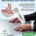 USD 177,  Effective Dupuytren Contracture New Treatment Options &ndash; Restore Hand Mobility