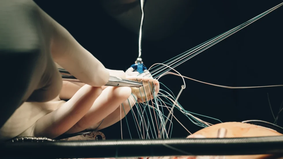 Bangalore, Health, Minimally Invasive Heart Valve Surgery &ndash; Faster Recovery