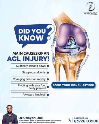 Bhubaneswar, Health, ACL Injury Causes | Orthopaedic Surgeon In Bhubaneswar | Dr Udayan Das.
