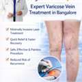 Best Vascular Surgeon In Bangalore