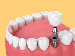 Lucknow, Dental, Pediatric Dentist In Gorakhpur