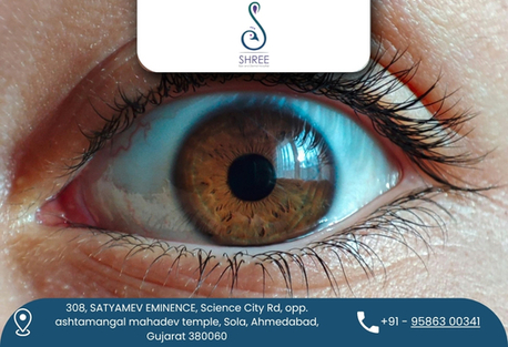 Ahmedabad, Health & Beauty Items, INR 1,  Leading Eye Hospital For Refractive Surgery In Ahmedabad