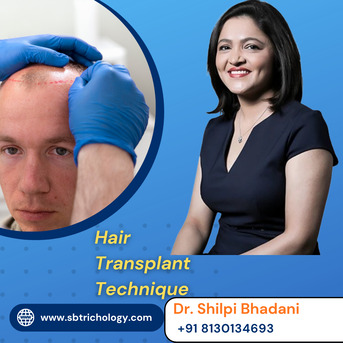 Gurgaon, Health, Advanced Hair Transplant Techniques In Gurgaon &ndash; Book Now