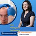 Advanced Hair Transplant Techniques In Gurgaon &ndash; Book Now