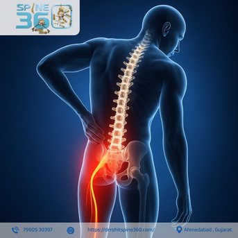 Ahmedabad, Health, Trusted Spine Tumor Specialist In Ahmedabad - Dr. Rohit Spine 360