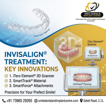 Hyderabad, Dental, EXPERIENCE THE FUTURE OF ORTHODONTICS WITH INVISALIGN  - Smile Dental And Implant Centre