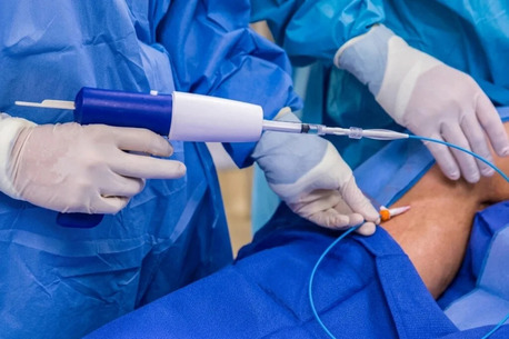 Mumbai, Health, Advanced VenaSeal Care For Effective Varicose Vein Management