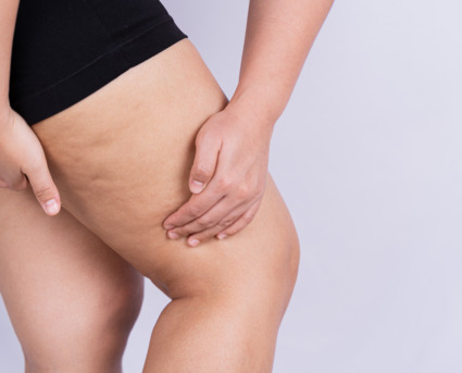 Dubai, Health, Thigh Lift In Dubai | Dr. Juan Carlos