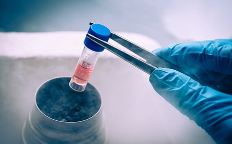 New Delhi, Health, Fertility Preservation In Delhi - Dr Rhythm Gupta