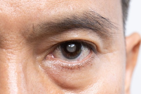 Singapore, Medical, Asia Retina Eye Surgery Centre