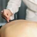 Natural Healing Options With San Francisco Acupuncture Services