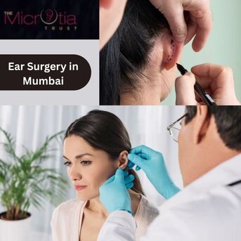 Mumbai, Health, Prominent Ear Correction In Mumbai: Expert Care At The Microtia Trust