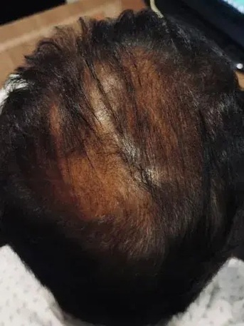 Singapore, Health, Oriental Hair Solutions